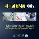 김포시신경외과 타는 듯한 허리통증 척추관협착증 증상 의심 이미지