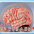 나를 잊게 만드는 치매, 뇌 노화를 늦춰라! 이미지