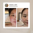 세븐일레븐 광주첨단대라수점 | 13년 경력 광주 첨단토탈샵 피부관리 정원에스테틱 베이직 관리 후기