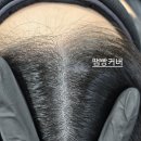 블랙샌드뷰티 네이버블로그