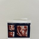 경훈농장 | 7월 셋째 주 (임신 12주차 기록)