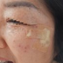 현대프라자약국 | 부산 양정 봄한의원 흑자제거비용 내돈내산/동백전사용/주차장