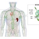 항암치료 중 부작용으로 림프절이 부을 수 있나요..? 이미지