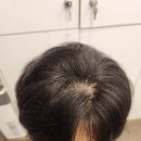 증모가발(퀸즈헤나 남천점) | 환기잘 되는 가벼운 가발