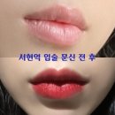 분당 서현 립타투 반영구 전문 병원 자연입술 문신 후기