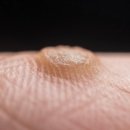 포이즌의원 이미지