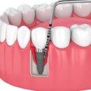 울산의원 이미지