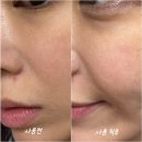 나노코스메 | 식물성엑소좀 토너 엑솜토너로 속건조 민감 피부 홈케어 관리 끝!