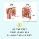 OX로 풀어보는 ‘회전근개(=어깨 힘줄) 파열’에 대한 모든 것! 이미지