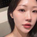 라임 | 강남피부과 울쎄라 피프라임 후기 효과·통증·가격 내돈내산