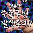 영유아 수족구병 발생주의❗️ 이미지