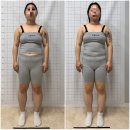 파리바게뜨서면1번가점 | 부산서면두골비 얼굴비대칭관리 로온 얼굴안면비대칭&amp;자이로토닉 후기