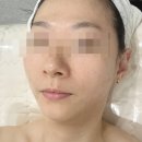창원피부관리 이너프에스테틱 토닝 물방울리프팅 관리후기