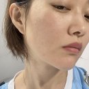 스킨액츄얼리 속보습 케어에 좋은 수분에센스 추천