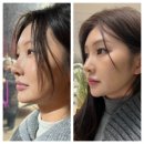 시너지 - 남구 용호동 | 시너지다이어트 원팩으로 염증 관리한 후기