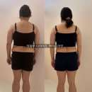 105 | 의정부 위고비, 마운자로 후 부작용..!! 다이어트 후관리가 중요해요