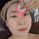 순환 | 동래 에스테틱 추천 더노블메디센터 수분 보습 붓기 림프순환관리 후기