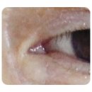 최인평의안 이미지