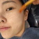 내서읍144 | 마산 내서 맑은빛에스테틱 물방울리프팅 리얼후기 내돈내산 후기