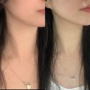 브이워시 | 부산 서면 리프팅 브이로 내돈내산 솔직후기