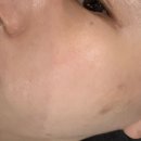 한 번만에 이럴 수 있어..? 하단 피부관리 &#34;퓨어 스킨 앤 바디&#34; 리얼 후기
