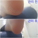 푸스올 이미지