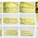 바른치과기공소 이미지