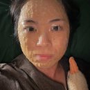 위드팜가까운지하철약국 | [결혼준비6-2] 편평사마귀 제거 후기 (내돈내산, 광고 절대X)