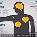 명일엠의원 네이버블로그