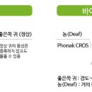보아스보청기