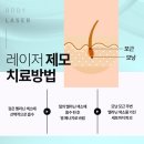 뷰센스의원 이미지