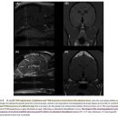 Canine pituitary gland의 MRI상 Variations 이미지