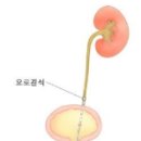 장산닥터남비뇨의학과의원 네이버블로그