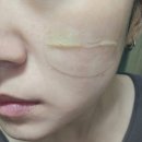 동안피부 프로젝트 천연화장품, 천연비누 만들기 | 노탈리 타미텐 겔 공구로 만난 진정 보습 쿨링 만능템 홈케어 사용법