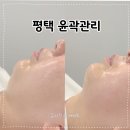 오름뷰티 - 부산진구 | 평택윤곽관리 고민이라면? 오름뷰티 쏙프팅으로 얼굴 라인 관리 받고 온 후기