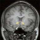 측좌핵은 어디에 있을까? 이미지