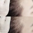 논현큰사랑약국 | 신사역 논현역 헤어라인 문신 솔직 교정 가격 후기