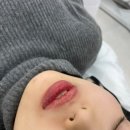 유진사우나 | [선릉] 입술문신 에이샵뷰티｜처음 해본 1차 시술 과정 &amp; 회복 후기