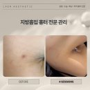 라에르