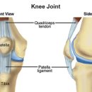 팔머메디스포츠 이미지