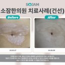 하얀마음한의원 | 건선 재발 ? 강남건선한의원에선 <이렇게> 방지합니다