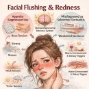 Dr. 고 신경정신과의원 | 주사피부염 치료 후기- 열감 홍조 5년 지속 환자, 3회 치료 후 90% 호전 사례