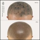 탈모왕 본점 이미지