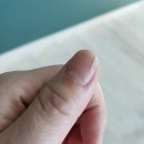 주방 필수템 채칼, 알고 보면 무섭습니다 – 베임 방지 장갑 추천