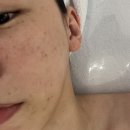 람세스피부관리 | 논산 신부 웨딩 관리 피부관리샵 내돈내산 모아르 에스테틱