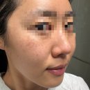 글루타치온앰플 순수비타민C앰플. [바이탈포션 슈퍼 글루타씨온 앰플] 사용 후기