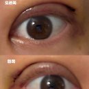 인더라인25시편의점 | 🌟 [1] 절개 인아웃라인 — 1주일 후기