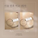 몽드로쉐