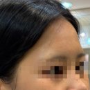 아르떼뷰티 하단점