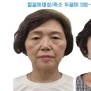 두골비